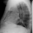 Sunshine C-Pulse Device