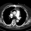 Sunshine C-Pulse Device