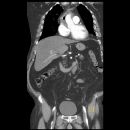 Sunshine C-Pulse Device