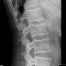 Deckplatte LWK 2 ohne Hinterkante