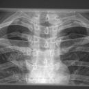 sterno-clavicular.jpg
